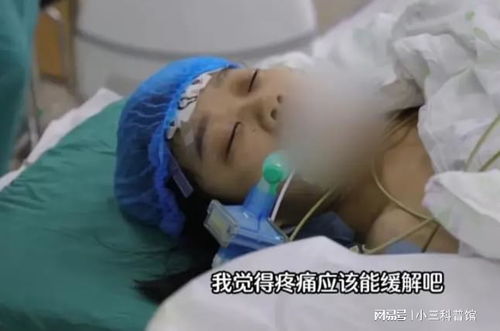 22岁女生取全部头皮救烧伤父亲