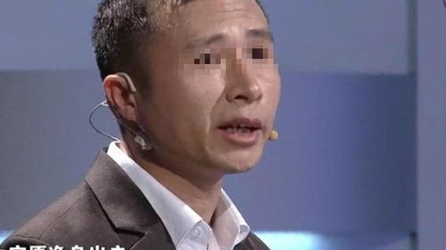 男子脸肿4天后意外吸住磁铁