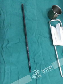 13岁男孩将55厘米数据线插进尿道