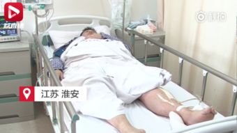 男子连打4小时麻将诱发血栓险丧命