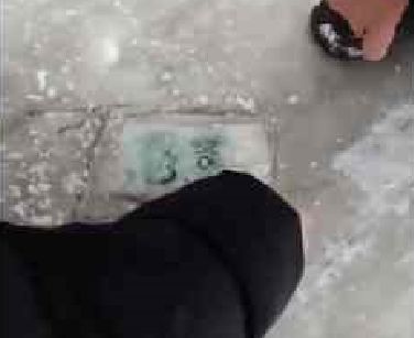 男子拆快递遭横祸几十根细刺扎眼球