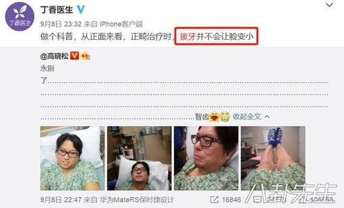 被拔错牙坠亡女子家属与相关方和解