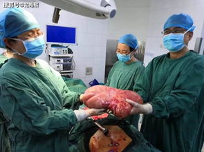7旬老人没有肿瘤被切除5个器官