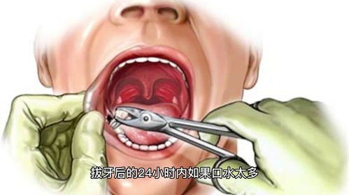多位捏捏玩家出现喉咙痛烂手指